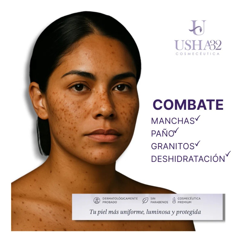 Kit Anti-manchas Mujeres Usha32: Limpieza, Sérum Y Protector