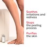 PODERM – IRRITATED AND SENSITIVE FEET – Repairs and Soothes