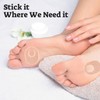 Pack of 24 Chicken Eyes Pressure Protection Rings, Chicken Eye