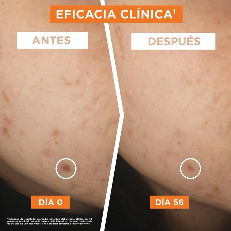 Kit Garnier Express Aclara Rutina Anti Manchas Vitamina Gel Limpiador