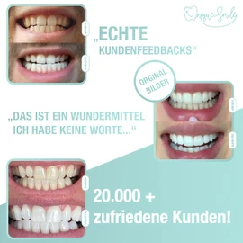 UniqueSmile High-Quality Teeth Whitening Kit, All-in-One Bundle for Teeth Brightening and White Teeth, Teeth Bleaching Set blue
