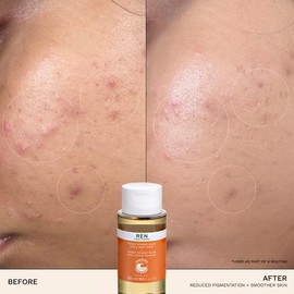 REN Clean Skincare Ready Steady Glow Daily AHA Tonic 250ml