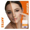 NEOPROSONE Crema Vitamina C 20% Despigmentante Facial Con Ácido Hialurónico