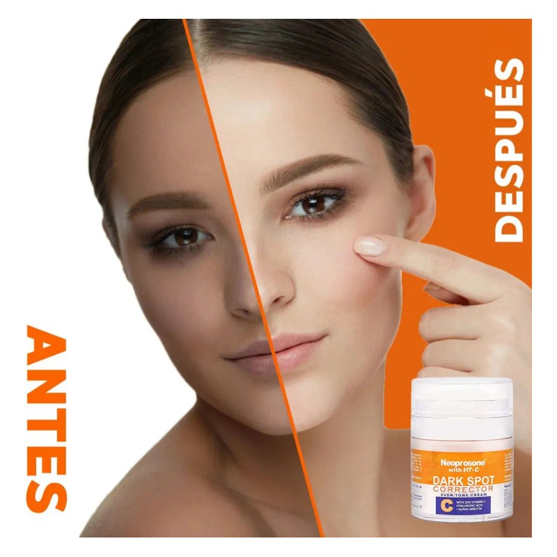 NEOPROSONE Crema Vitamina C 20% Despigmentante Facial Con Ácido Hialurónico