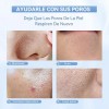 Exfoliador De Piel Anlan Ultrasónica Con Luz Roja Y Azul