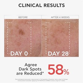 APIVITA Bee Tech Sérum C15 Propolis Correct – Sérum Antiedad con 15% Vitamina C + 1% Vitamina E + Propóleo Patentado AoX-CR - Luminosidad, Antioxidant