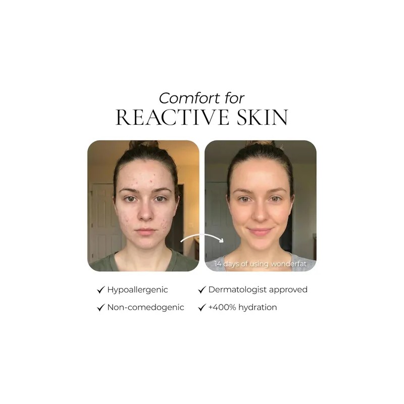 Bálsamo Sebo Res Natural Crema Hidratante Facial De Ternera