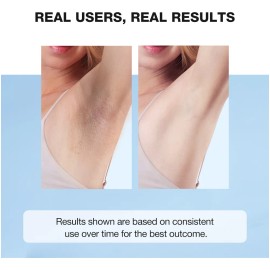 Crema Aclarante Axilas Entrepierna Rodillas Skinever Blanco