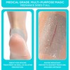 MedVance Soft Silicone Tape with Perforation for Easy Cut Size