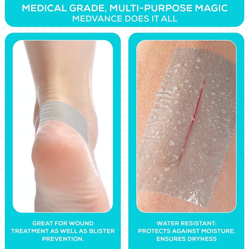 MedVance Soft Silicone Tape with Perforation for Easy Cut Size