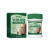 Vitiligo Cream, Natural Effective Vitiligo Treatment for Reduce White Spots