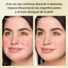 Crema con Ácido Azelaico al 10%, 50g