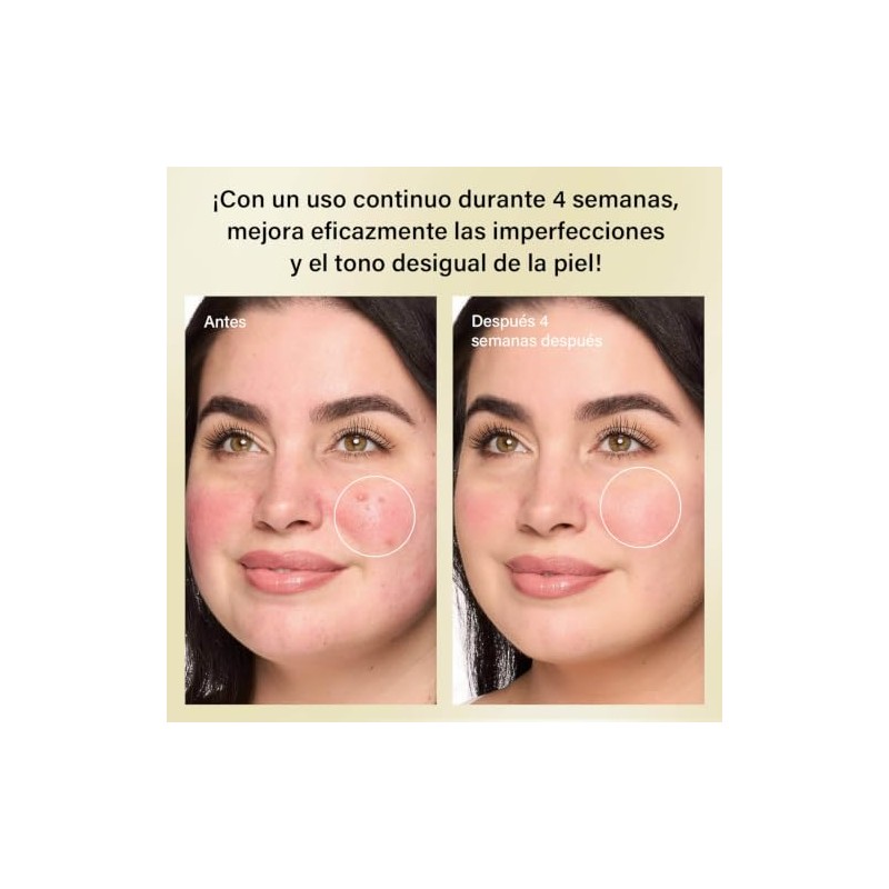 Crema con Ácido Azelaico al 10%, 50g