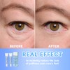 Instant Firming Eye Serum,Visibly Reduces Under-Eye Bags, Wrinkles, Dark Circles,