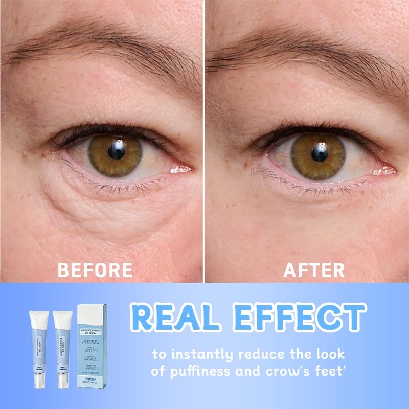 Instant Firming Eye Serum,Visibly Reduces Under-Eye Bags, Wrinkles, Dark Circles,