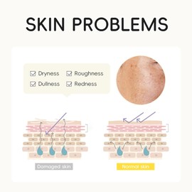 5PCS Yuzu Skin Care Sets & Kits - JAPAN Yuzu Skincare Set - Cleanser, Toner, Face Serum, Eye Cream, Face Cream - Skincare for Kids - Skin Care for Teenage Girls - Facial Kit for Women - Travel Kit