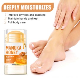 2pcs Hand & Foot Cream - Honey Foot Cream For Cracked Heels And Dry Skin - 60% Urea Cream Plus 2% Salicylic Acid For Hard Skin Remove - Intensive Moisturising Heel Cream For Women And Men