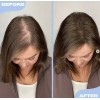 Sérum Para Crecimiento De Cabello Y Cuero Cabelludo 20ml