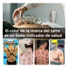 Oyania Juego De Ventosas De Vacío, Dispositivo De Ventosas, 16