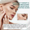 3 Meters Silicone Scar Stickers to Reduce Itching and Redness