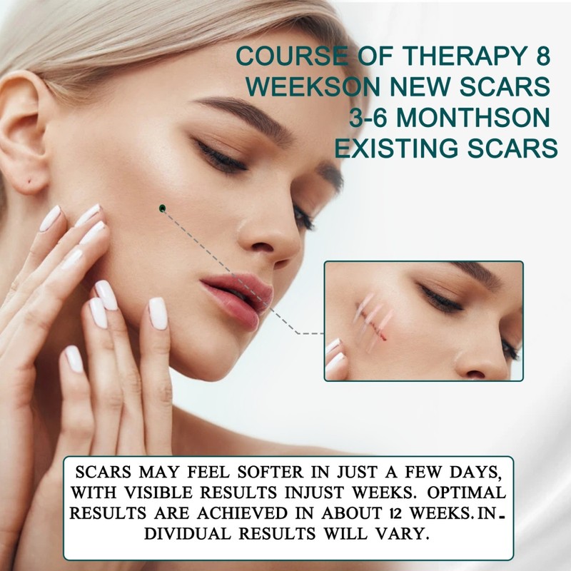 3 Meters Silicone Scar Stickers to Reduce Itching and Redness