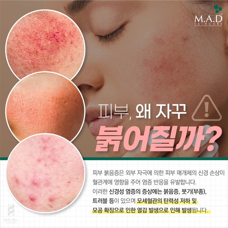 Mad Skin Care Rescue Serum 30g / 매드스킨케어 레스큐세럼30g
