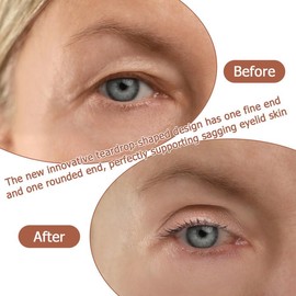 720 PCS Schlupflider Tapes Augenlid Stripes Unsichtbar Kommt mit 2 Werkzeugen Geeignet für Schlupflider Eyelid Tape Unsichtbare Doppellidstreifen Hautfreundlich Wonderstripes Schlupflider