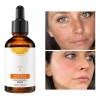 Serum Vitamina C Anti Envejecimiento Elimina Manchas 30ml