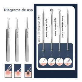 Limpiador Facial Ultrasónico Exfoliante Espinillas Belleza
