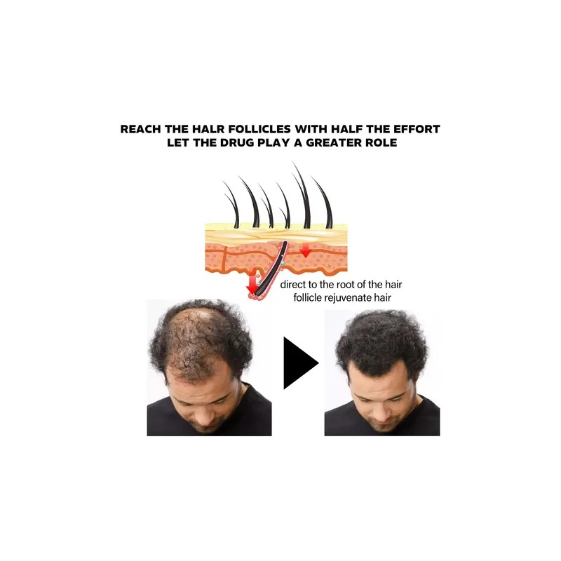Em Aceite Ginseng Y Gengibre Estimula Crecimiento Cabello