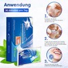 Teeth Whitening Strips - Whitening Stripes Set - White Stripes