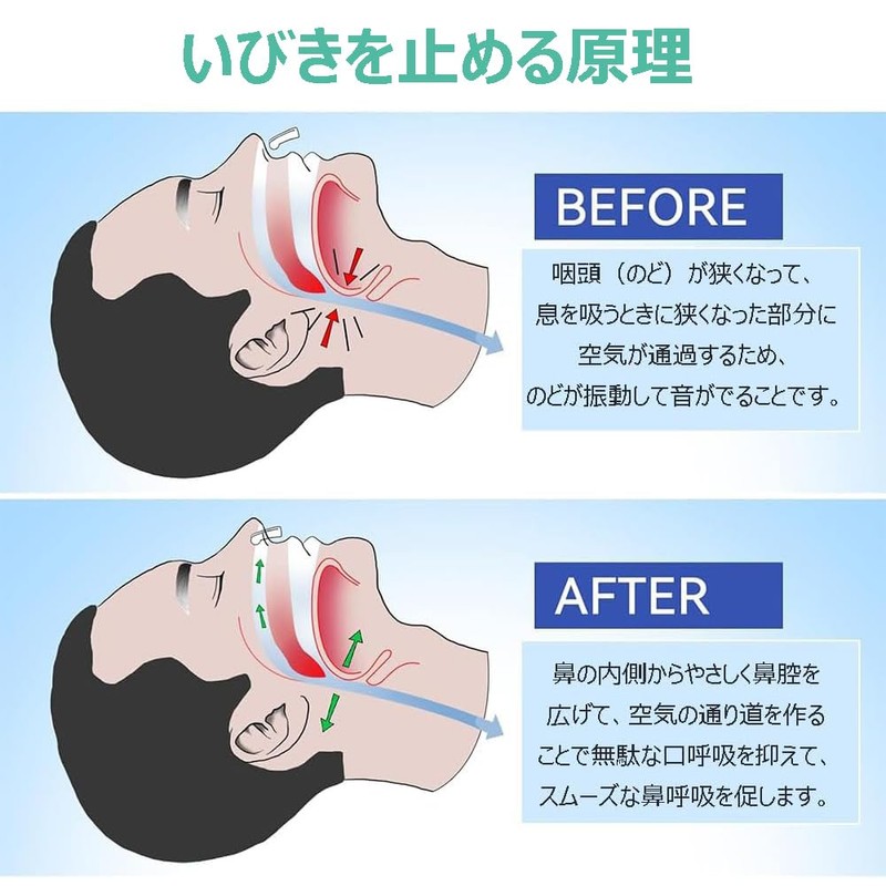 8個 いびき防止グッズ 鼻クリップ 収納ケース付き 鼾防止グッズ いびきグッズ いびき対策 イビキ 防止 鼻ピン