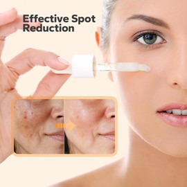 SilkySecret Dark Spot Correcting Serum (1 fl.oz), Dark Spot Improver for Face & Body, Niacinamide Serum for Uneven Skin Tone, Sun Damage, and Age Spots, Hyperpigmentation Solution