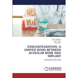 OSSEOINTEGRATION: A UNIFIED BOND BETWEEN ALVEOLAR BONE AND IMPLANT: OSSEOINTEGRATION