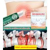 Lumbar Spine Relief Cooling Compress Gel for Soothing Comfort HZ