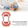 Periodontal Disease Teeth Resin Model Dental Demonstration Teeth Model for