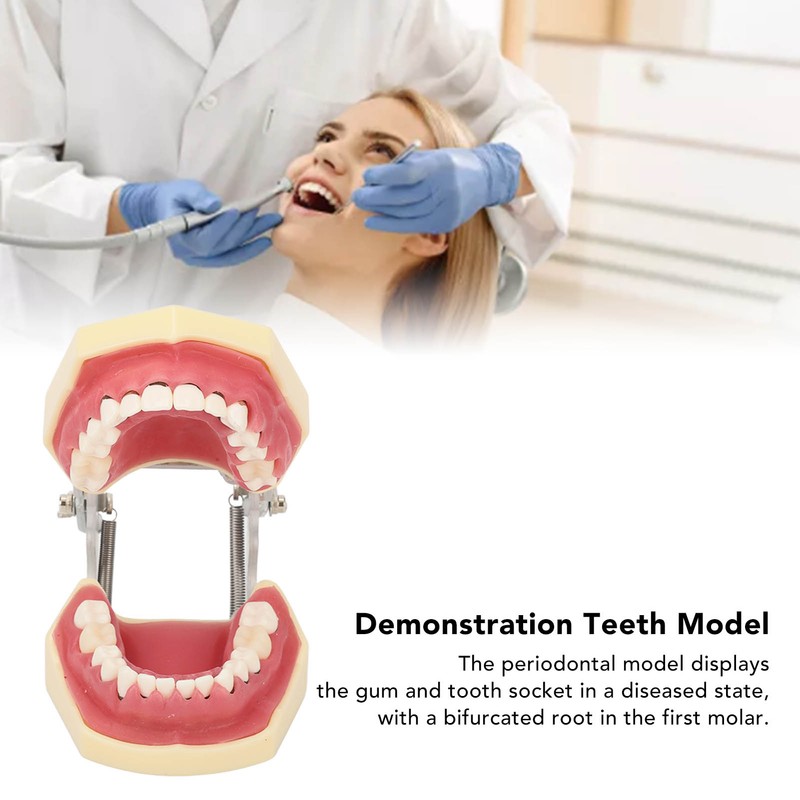 Periodontal Disease Teeth Resin Model Dental Demonstration Teeth Model for
