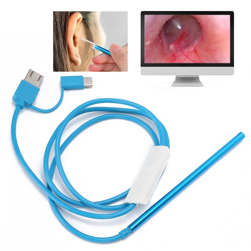 3‑In‑1 Visual Earpick Visible Ear Spoon Long Handle Examination Endoscope