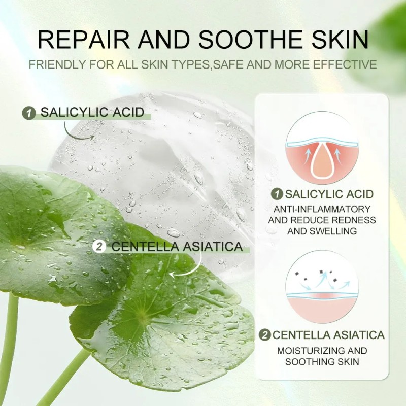 Sace Lady Parche Antiacné Hidrocoloide Para Rostro Aisla Todo Tipo