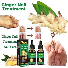 Ginger Nail, Tratamiento de Uñas con Jengibre, Cuidado de Uñas