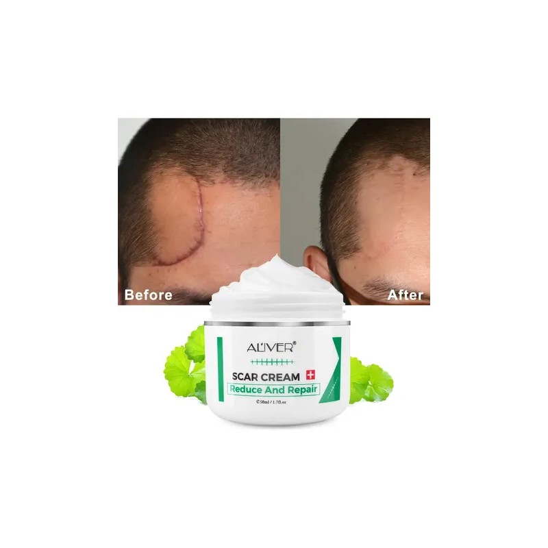 Crema Repara Cicatrices Antiedad Quemaduras Estrías
