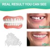 Dentures, upper and lower jaw cosmetic dentures, false teeth, cover