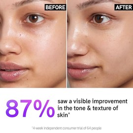 The INKEY List Suero de Vitamina C y EGF al 15 Ayuda a Aclarar Intensivamente Todo Tipo de Piel 30 ml                                                 