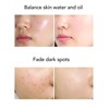 Facial Oxygen Spray Injector Red Blue Light High Pressure Fine