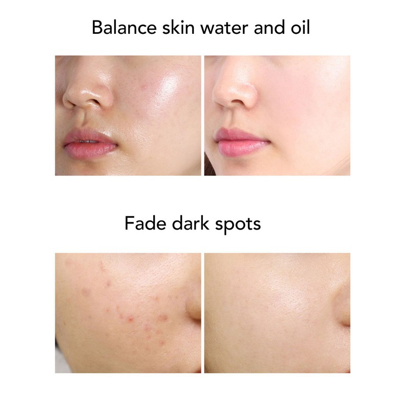 Facial Oxygen Spray Injector Red Blue Light High Pressure Fine