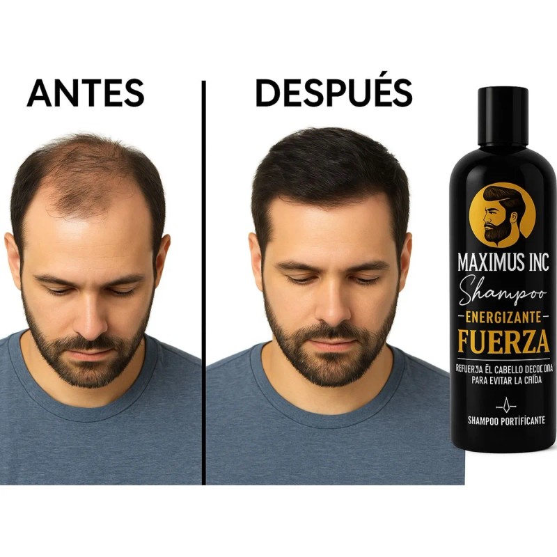 Shampoo Anticaída Hombre Fuerza Crecimiento Hombre 500ml mx