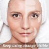 Maitys 16 Pcs Silicone Face Patches, Reusable Soft and Comfortable,