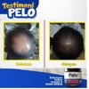 PELO Hair growth- PELEBAT RAMBUT DAN JAMBANG - BALM BUAH