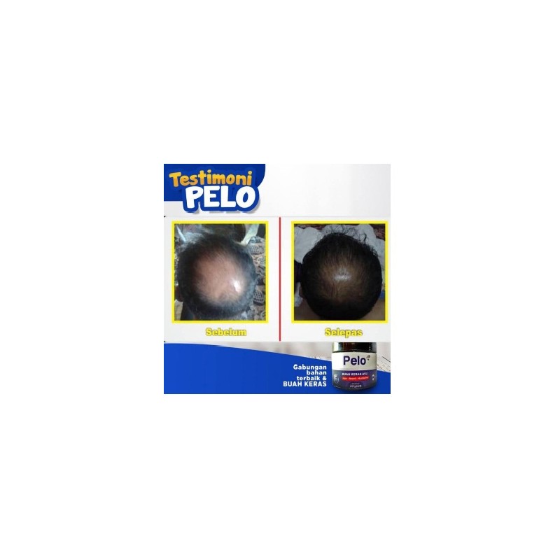 PELO Hair growth- PELEBAT RAMBUT DAN JAMBANG - BALM BUAH