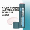Blistex Medicated Lip Balm, 0.15 Ounce, Pack of 5 –